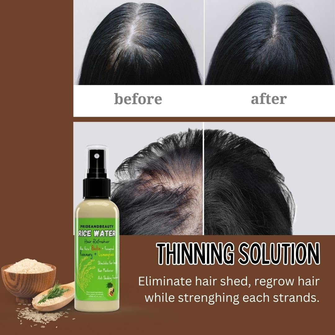 NEW Fermented Rice Water for Hair Growth - Infused with Rosemary, Biotin, Caffeine, Keratin Vegan Non-Greasy Spray Naturally Thicker, Longer, Softer Men & Women (4 OUNCES, Rosemary Lemongrass)