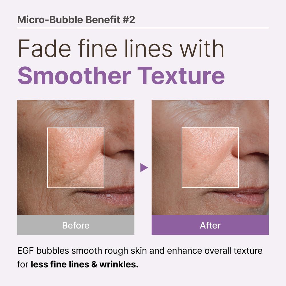 MENOKIN 30 Seconds Quick Bubble Mask [REPAIR] - [EGF Liposome] in Micro-bubbles for Skin Restoration, Hypoallergenic Bubble Capsule for Deep Repair, Korean Skin Care Essential, 50 Uses, 2.36 fl.oz