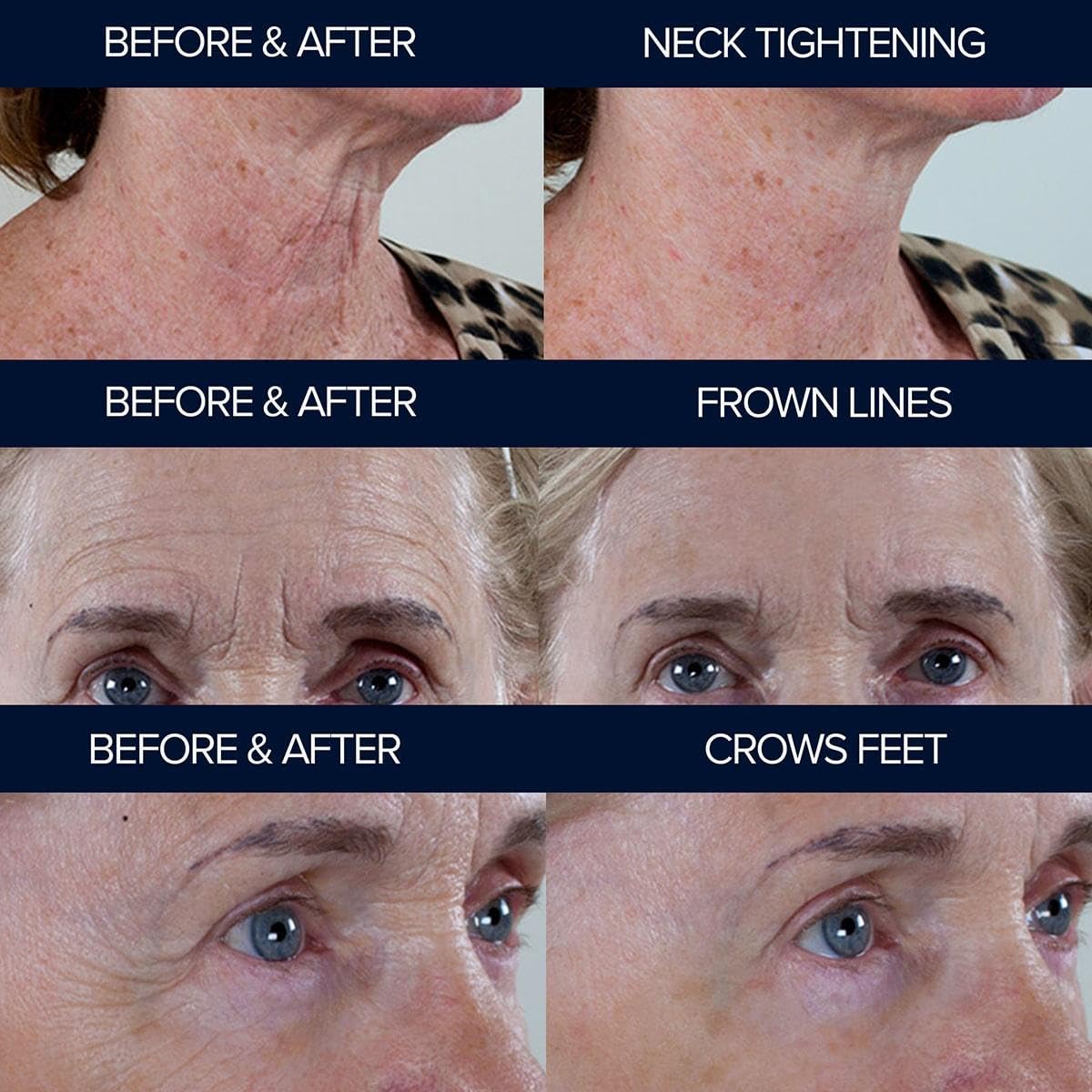 Peptide10 – Anti-Aging Peptide Serum – Firms, Smooths & Reduces Wrinkles – With Multi-Peptide Complex for Youthful Skin