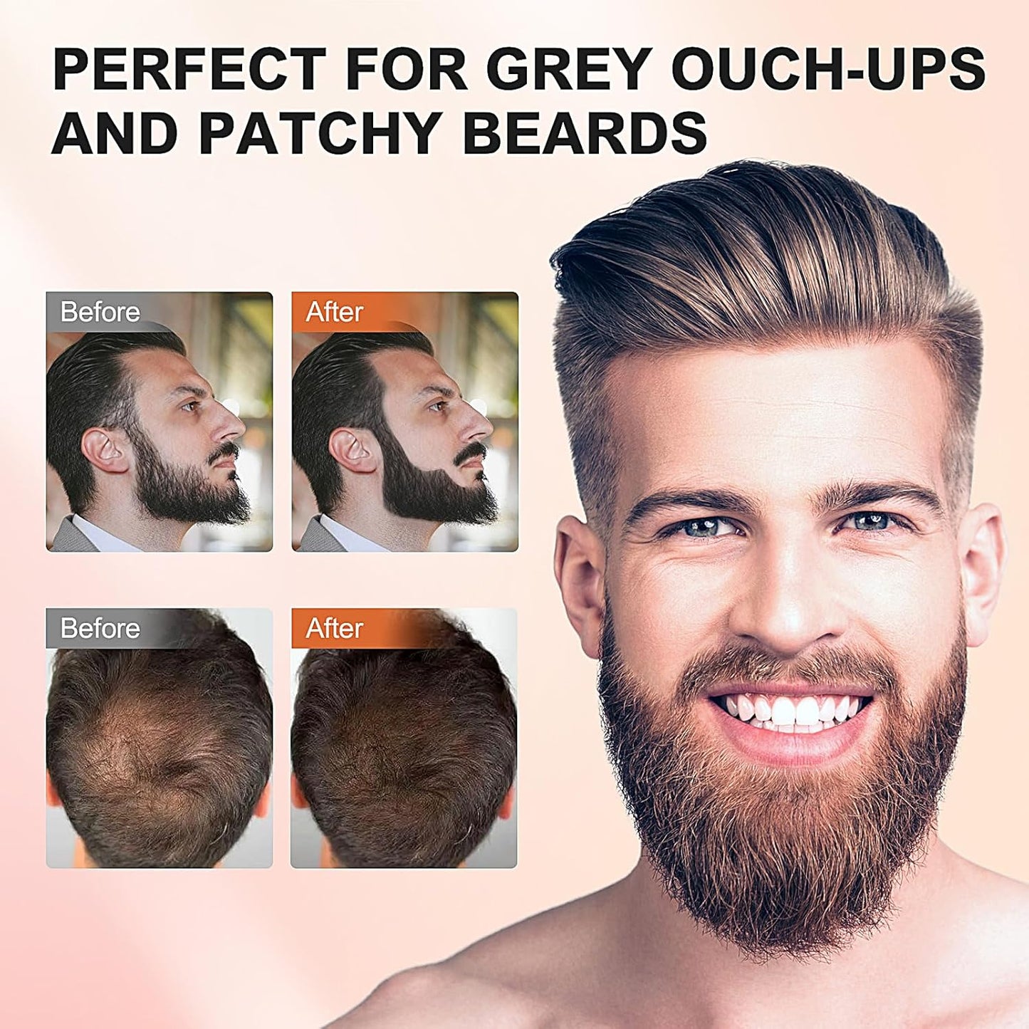 Instantly Cover Gray Hair, Thinning Hairline, Bald Spots, and Beard Lines - Root Touch Up Powder for Women and Men (Dark Blonde)